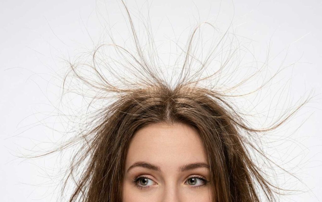 What Is "Staticky Hair"?