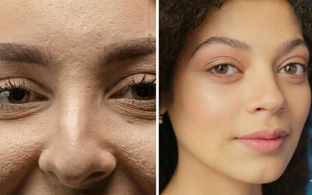 common mistakes to avoid