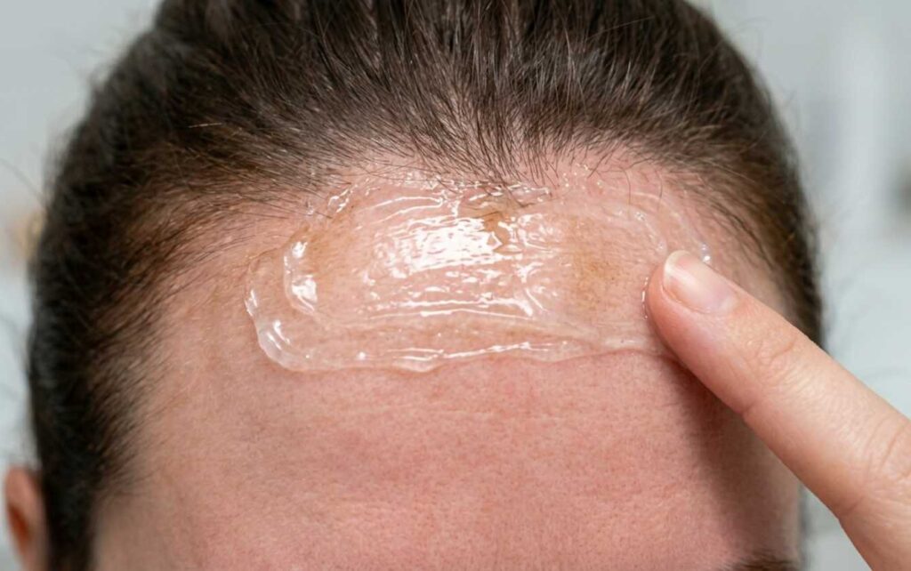 Remove Hair Color From Skin with Petrolium jelly