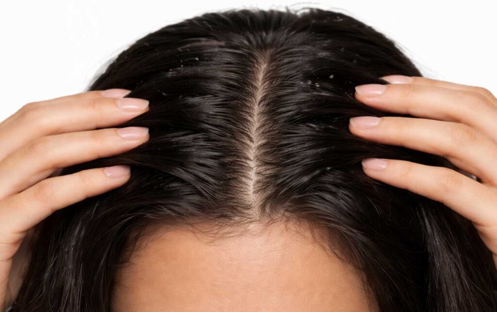 Why Does My Hair Get Oily so Fast